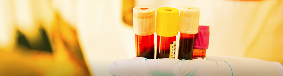 Imagen de unos tubos de ensayo con muestras de sangre sujetadas por una mano con guante